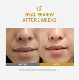 Kojic + Niacinamide Brightening Serum — Fade Dark Spots, Reveal Glow