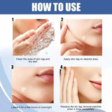 Star Pimple Patches — Overnight Blemish Rescue (Up to 1680 Pack)